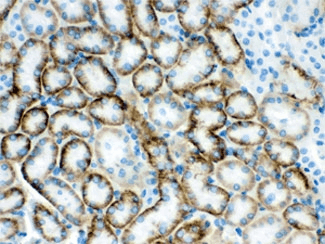 Polyclonal Rabbit anti-Human SLC22A2 Antibody (IHC, WB)