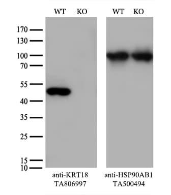 KRT18 / CK18 / Cytokeratin 18 Antibody (aa69-372, clone OTI10G8)