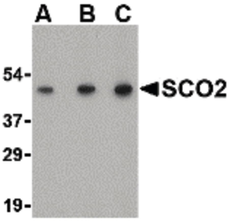 IHC-plus™ SCO2 Antibody