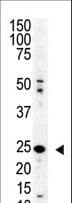 Polyclonal Rabbit anti-Human SENP8 Antibody (aa4-35, WB)