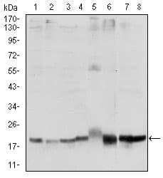 Monoclonal Mouse anti-Human SKP1 Antibody (clone 4E+11, IHC, IF, WB)