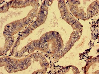 Polyclonal Rabbit anti-Human SMG6 Antibody (aa251-511, IHC)
