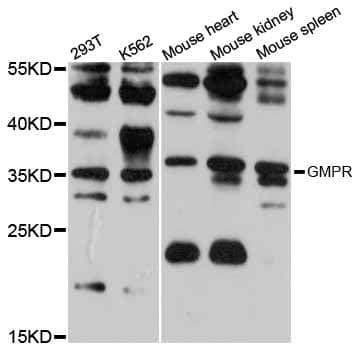 IHC-plus™ GMPR1 / GMPR Antibody