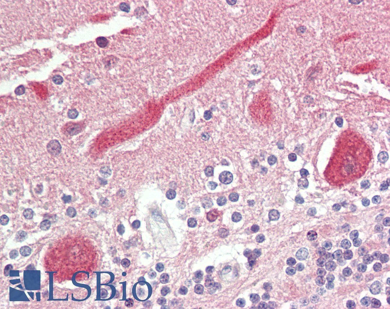 IHC-plus™ Polyclonal Rabbit anti-Human FADS1 Antibody (aa303-332, IHC, WB)