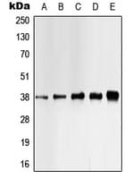 CSNK1A1 / CK1 Alpha Antibody (phospho-Tyr321)