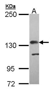 CFH / Complement Factor H Antibody (aa527-618)