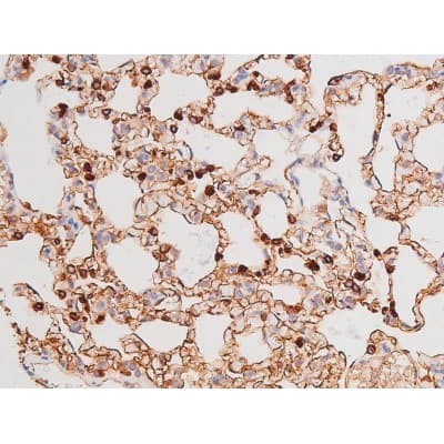 c-Kit / CD117 Antibody (phospho-Tyr703)