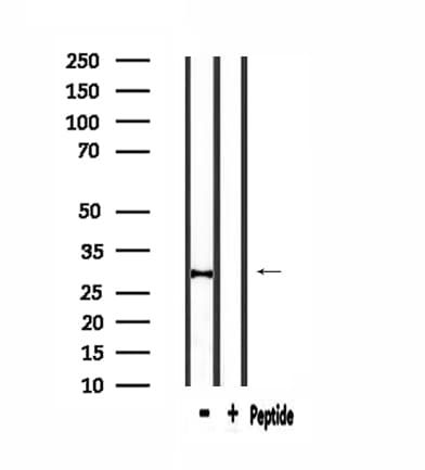 Polyclonal Rabbit anti-Human C1QG / Complement C1QC Antibody (IHC, WB)