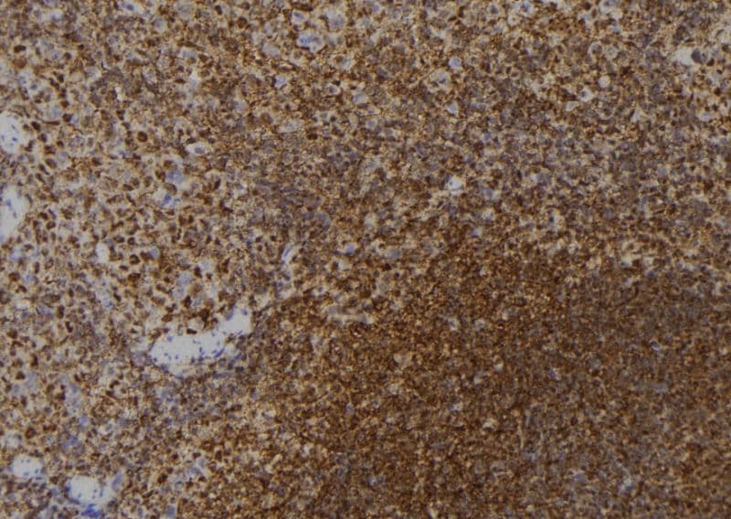 ZNF416 Antibody