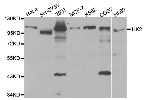 IHC-plus™ Polyclonal Rabbit anti-Human HK2 / Hexokinase 2 Antibody (IHC, IF, WB)