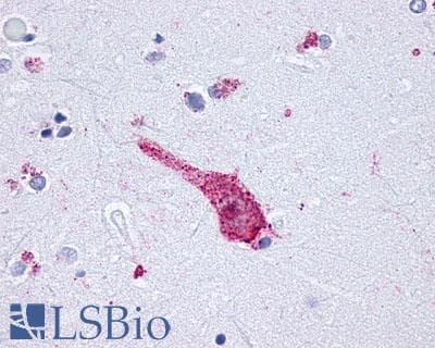 PathPlus™ OPRM1 / Mu Opioid Receptor Antibody (C-Terminus)