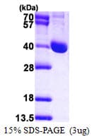 Human LCMT1 Protein (Recombinant His)