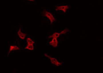 Polyclonal Rabbit anti-Human PRKCD / PKC-Delta Antibody (IF, WB)