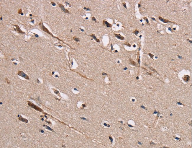 TRAFD1 / FLN29 Antibody