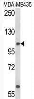 Polyclonal Rabbit anti-Human CASD1 Antibody (aa97-126, WB)