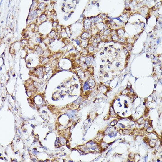HSPC167 / CDK5RAP1 Antibody