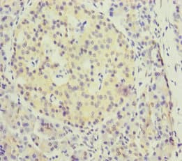 Polyclonal Rabbit anti-Human KIFC3 Antibody (IHC)