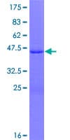 Human SP140 Protein (Recombinant GST)