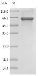 Rat SULT1B1 / Sulfotransferase 1B1 Protein (Recombinant 10His-SUMO, N-terminus + Myc, C-terminus)