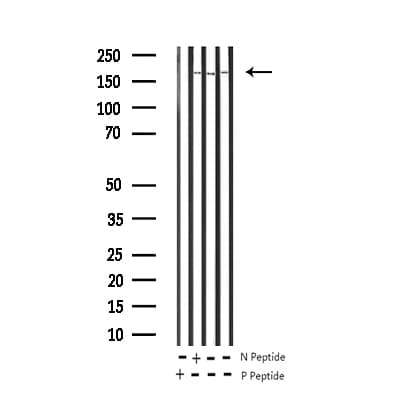 Polyclonal Rabbit anti-Human EGFR Antibody (phospho-Tyr1016, IHC, IF, WB)