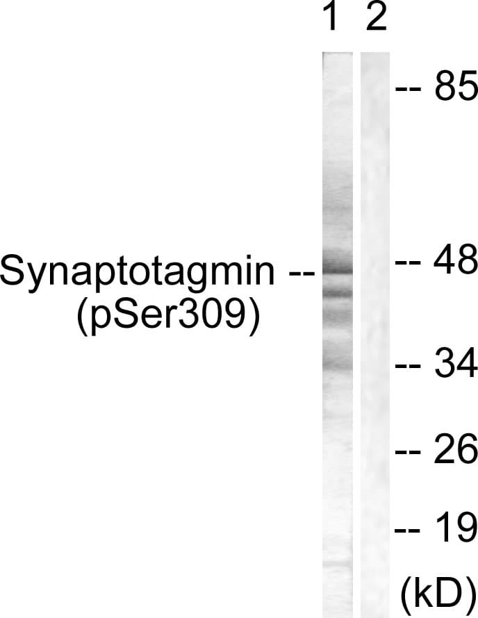 SYT1 / Synaptotagmin Antibody (phospho-Ser309)