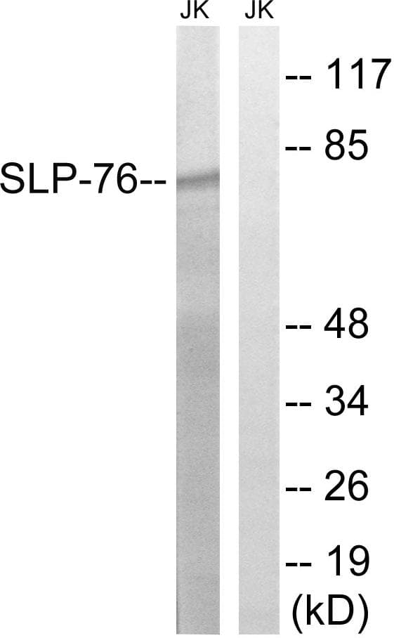 LCP2 / SLP-76 Antibody (p128)