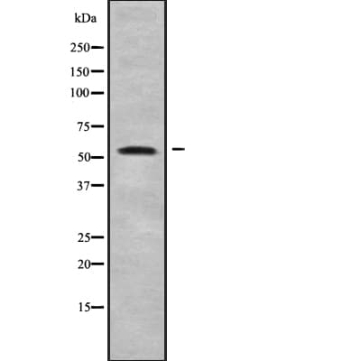 ALPPL2 Antibody