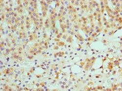 SULT2A1 / Sulfotransferase 2A1 Antibody (aa1-145)