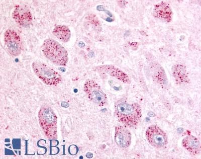 PathPlus™ Polyclonal Rabbit anti-Human NPBWR2 / GPR8 Antibody (Cytoplasmic Domain, IHC)