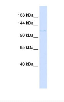 PTCH2 / Patched 2 Antibody (aa362-411)