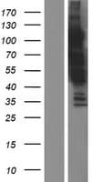 KIAA0355 Protein (Over-Expression Lysate Myc-DDK (Flag))
