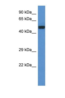 DLST / E2 Antibody (aa340-389)