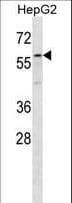 Polyclonal Rabbit anti-Human ZP4 / ZBP Antibody (aa445-474, IHC, WB)