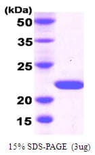 Human DHH / Desert Hedgehog Protein (Recombinant His)