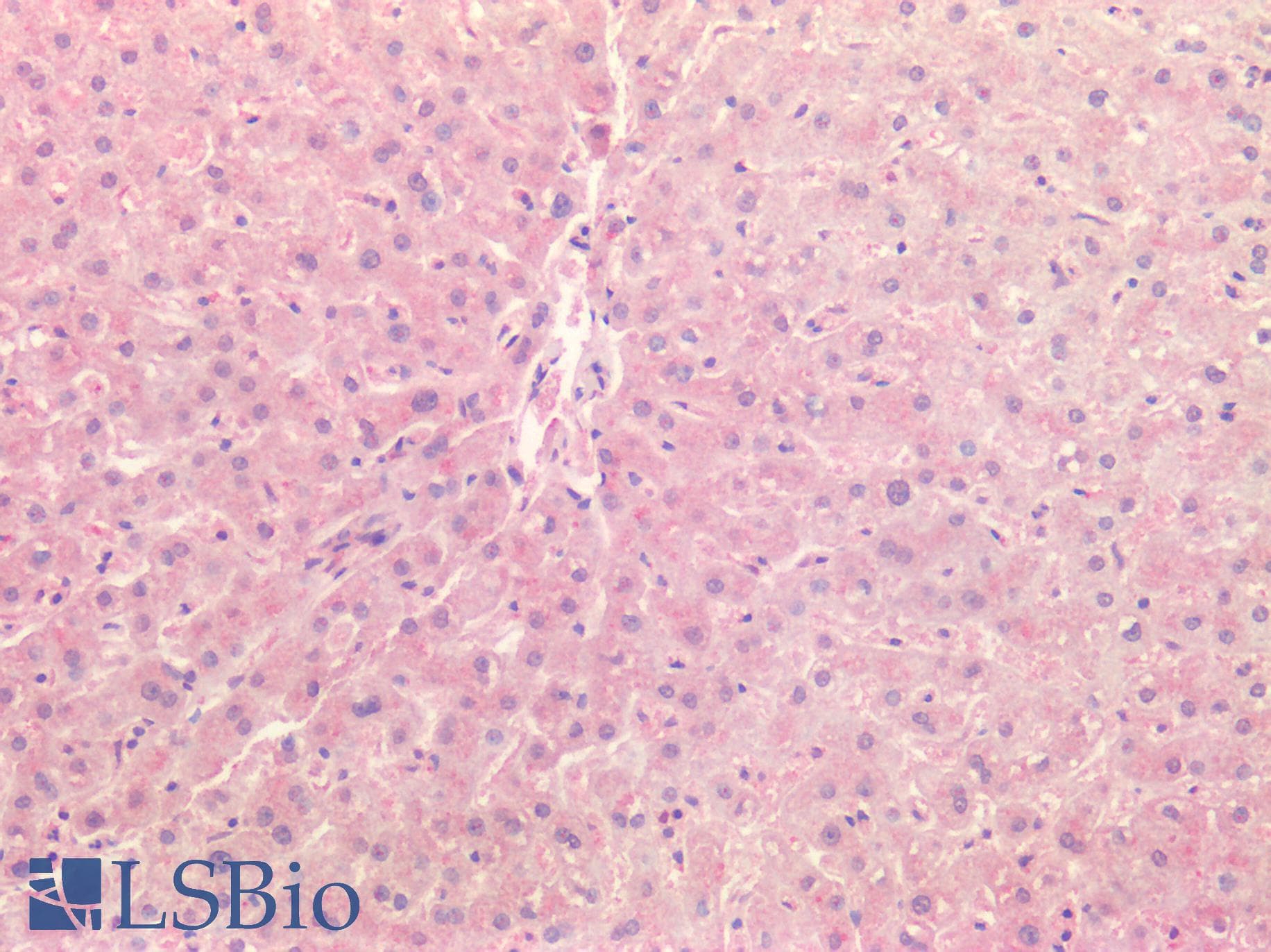 IHC-plus™ CTSK / Cathepsin K Antibody