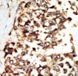 PKD2 / Polycystin 2 Antibody (aa937-968)