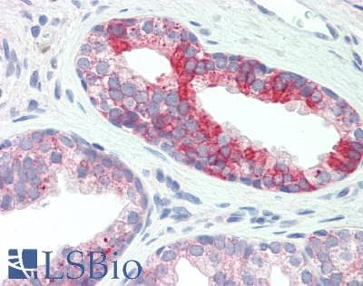IHC-plus™ PC / Pyruvate Carboxylase Antibody