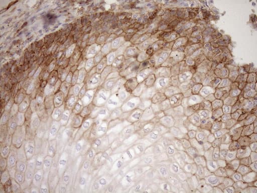 Monoclonal Mouse anti-Human EPLIN Antibody (clone OTI9F3, aa1-275, IHC, WB)