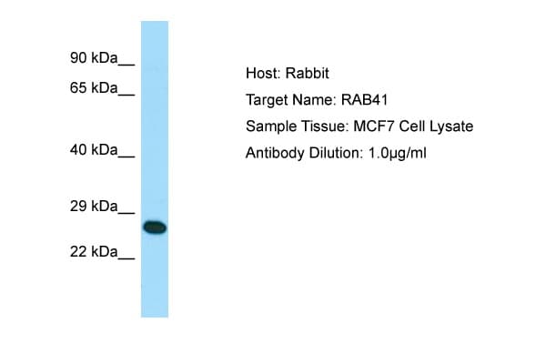 Polyclonal Rabbit anti-Human RAB41 Antibody (N-Terminus, WB)