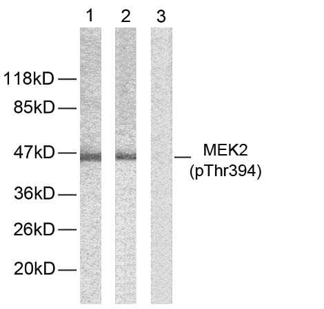 MAP2K2 / MKK2 / MEK2 Antibody (phospho-Thr394)