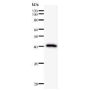 NRIP1 / RIP140 Antibody (clone 2656C6a)