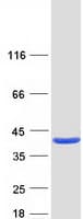 Human PDXK / PNK Protein (Recombinant Myc-DDK (Flag))