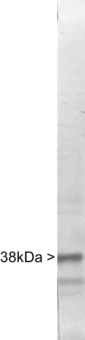 IHC-plus™ CSNK1A1 / CK1 Alpha Antibody