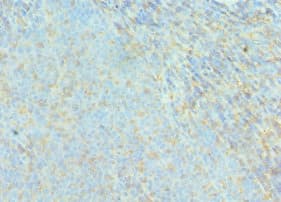 ACTR2 / ARP2 Antibody (aa1-160)
