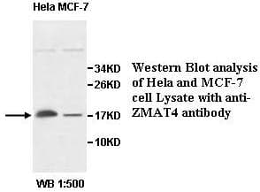 Polyclonal Rabbit anti-Human ZMAT4 Antibody (aa1-153, WB)