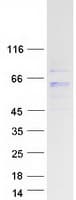 Human PM20D1 Protein (Recombinant Myc-DDK (Flag))