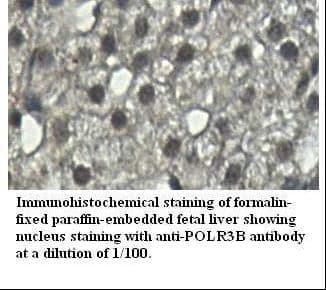 POLR3B Antibody