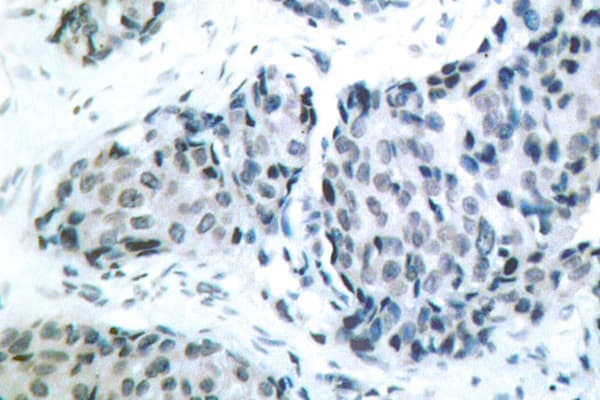 MAP2K4 / MKK4 Antibody (phospho-Thr261)