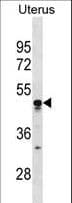 TIMD4 / TIM4 / TIM-4 Antibody (aa333-361)