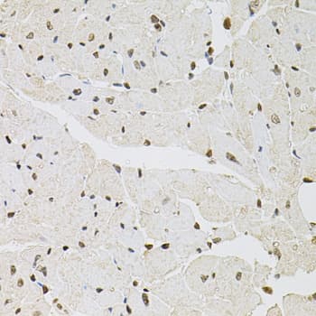 FRA-1 / FOSL1 Antibody
